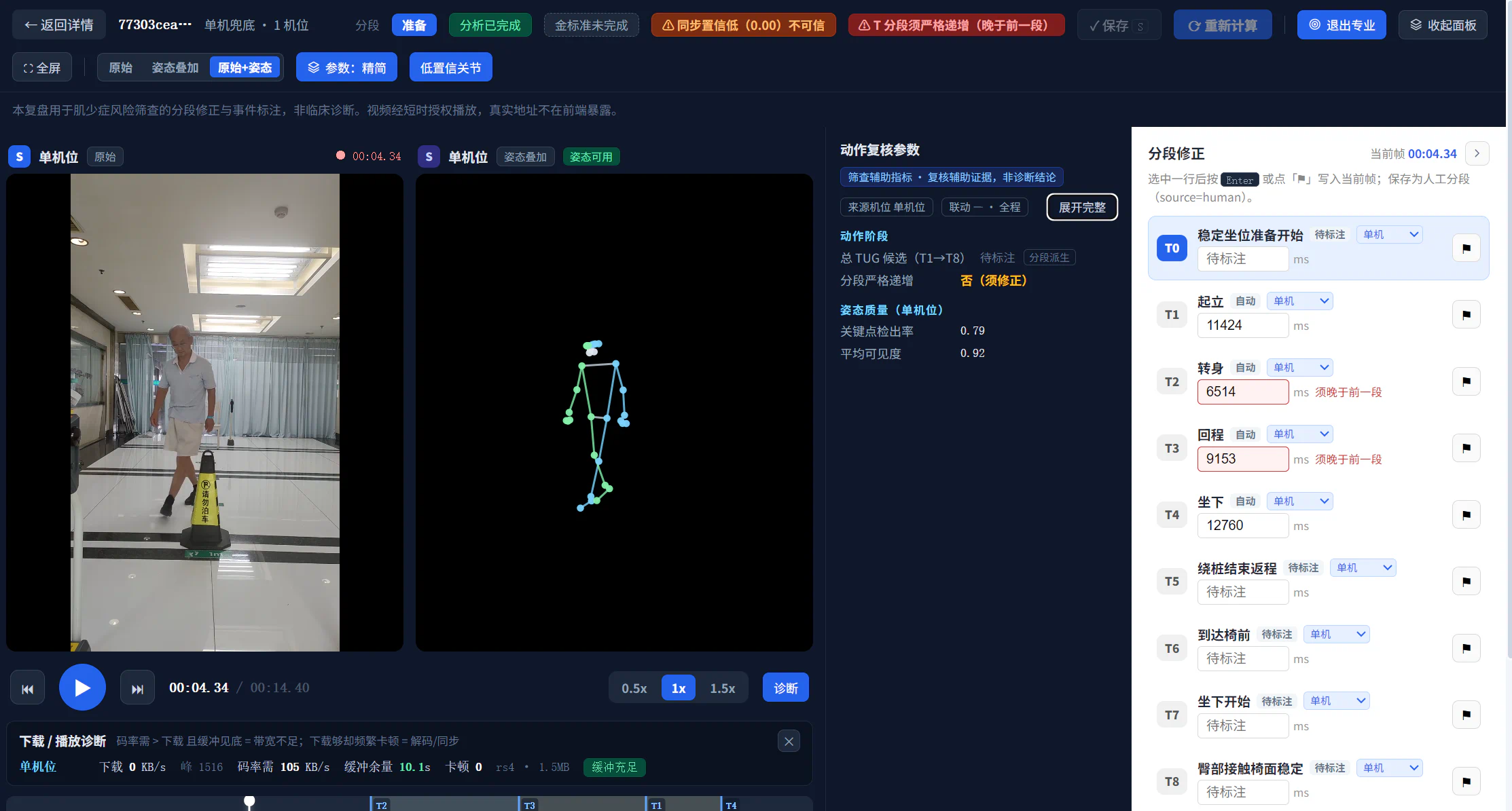 肌少症AI分析工作台，显示原始视频、33点骨骼姿态、动作阶段参数与风险分层